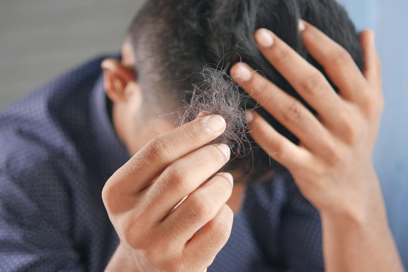 Hair Loss (PRP) Therapy