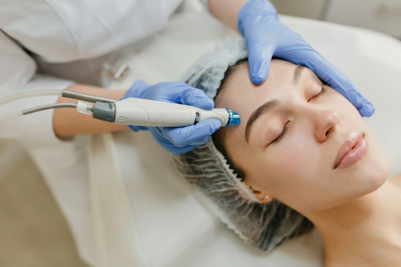 PRP Therapy